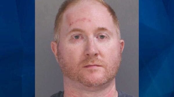 A man with short reddish hair and beard has visible red marks on his forehead and neck, wearing a dark shirt, against a plain background.