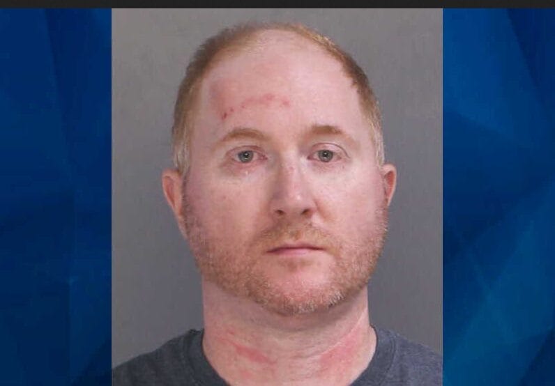 A man with short reddish hair and beard has visible red marks on his forehead and neck, wearing a dark shirt, against a plain background.